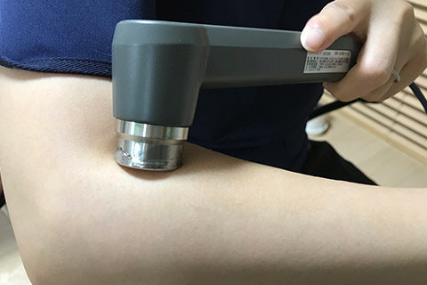 電気治療